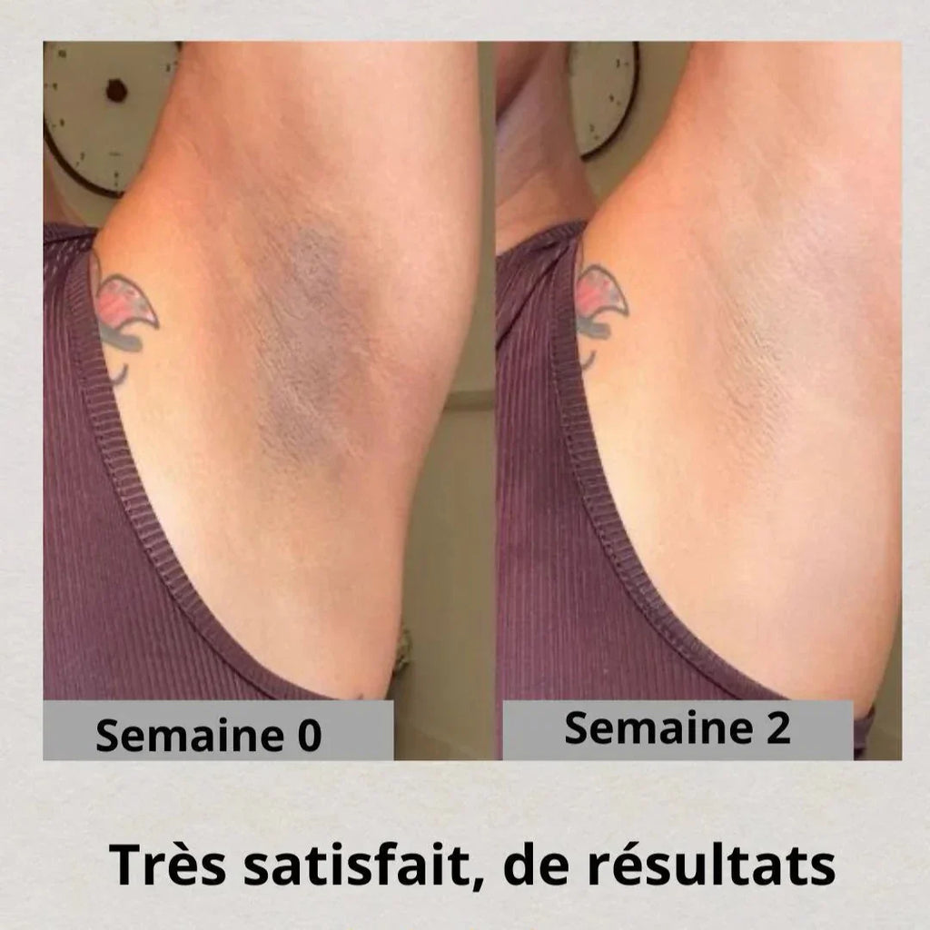 50 Pads au Curcuma : Zéro tâches avant les fêtes